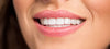 Comment avoir les dents blanches sans risque ?