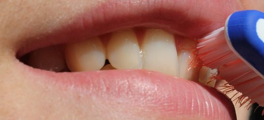 L'importance de l'hygiène bucco-dentaire ?